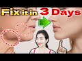 How to Lose Jowls and get a Firm, Defined Jawline in 3 DAYS