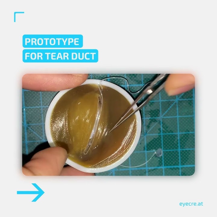 Download lagu Trauma Course at the University Eye Clinic in Graz, Austria