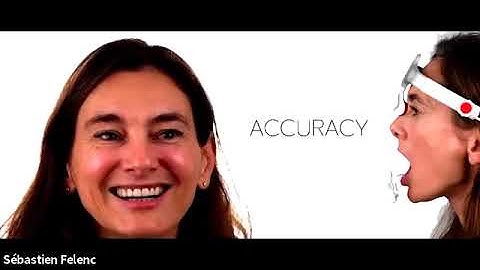 Introducing Modjaw   jaw motion scanner