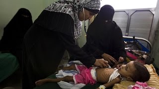أخبار الان في مدينة المكلا في اليمن تعاين الوضع الاقتصادي والاجتماعي للمواطنين