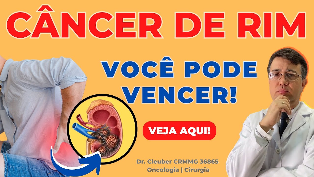 Câncer de Rim: Sintomas, Tratamento e Cura 🙏 - YouTube