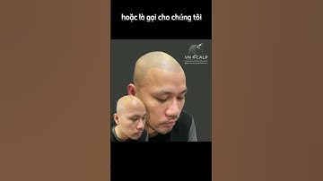 Cấy tóc tỉ lệ thành công là bao nhiêu%,  xăm tóc có thực sự đẹp  xem video nhé.. #scalp