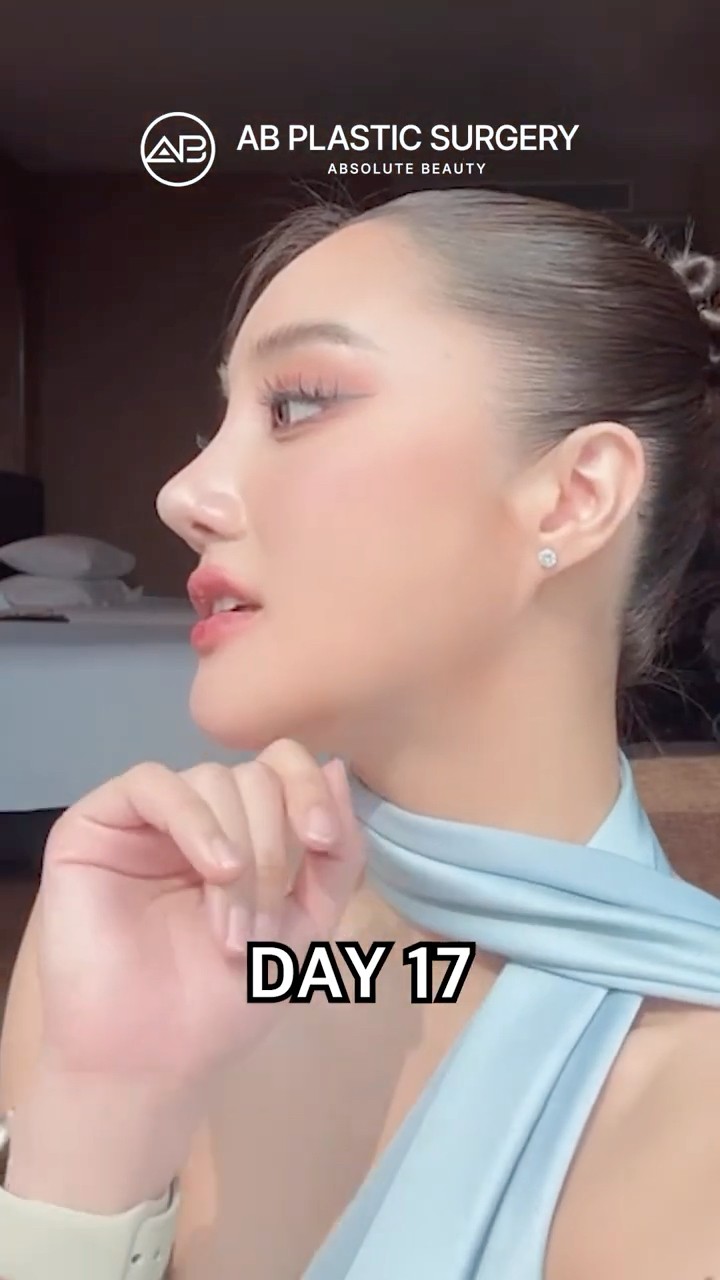 Barbie Nose Gone Wrong? Her Revision Reveal #shorts
