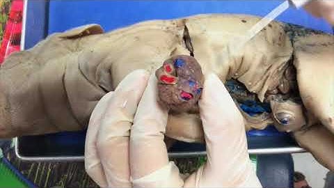 Pig Dissections   Circulatory System