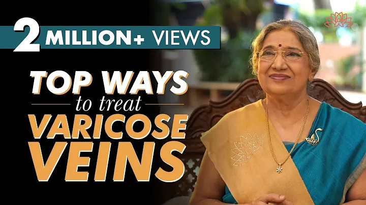 Get rid of Varicose veins | Dr. Hansaji Yogendra - DayDayNews