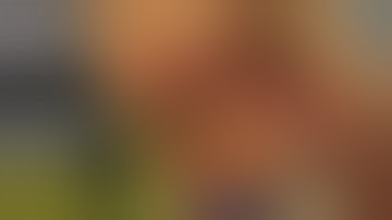 Sinus elevation : Crestal approach using DASK Simple