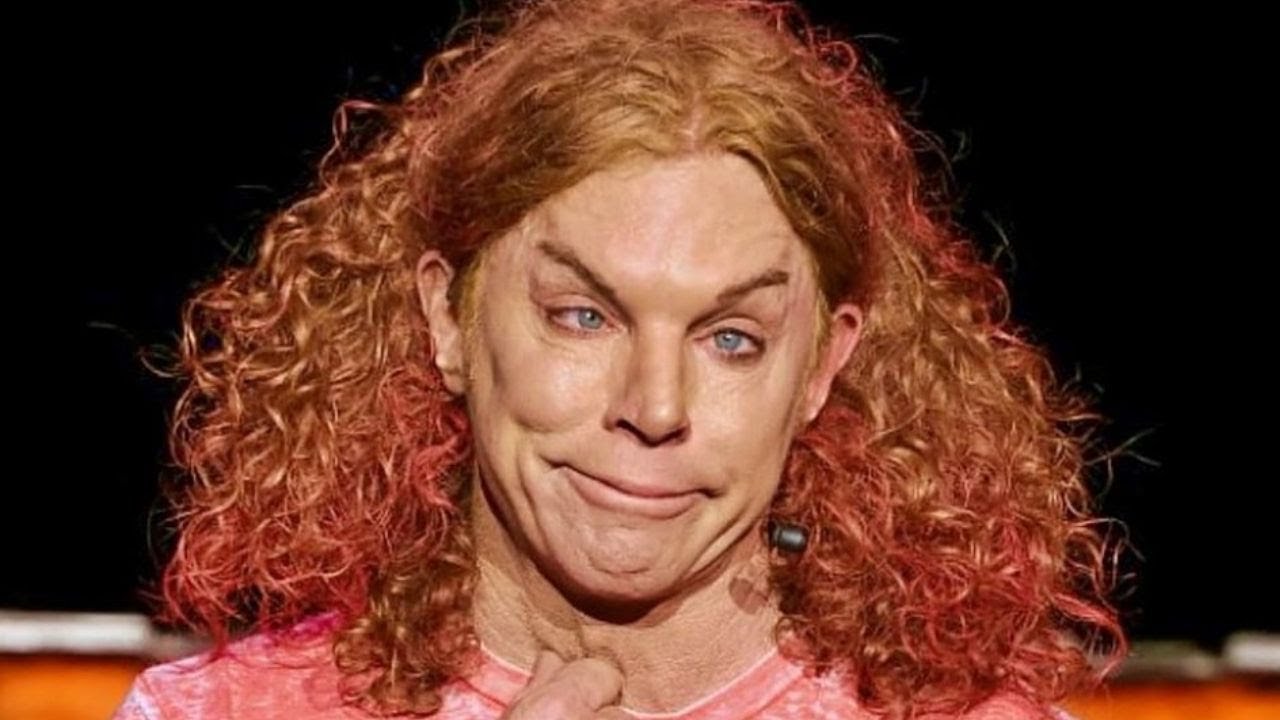 He Was A Famous Actor Before His Plastic Surgery Guess Who Carrot