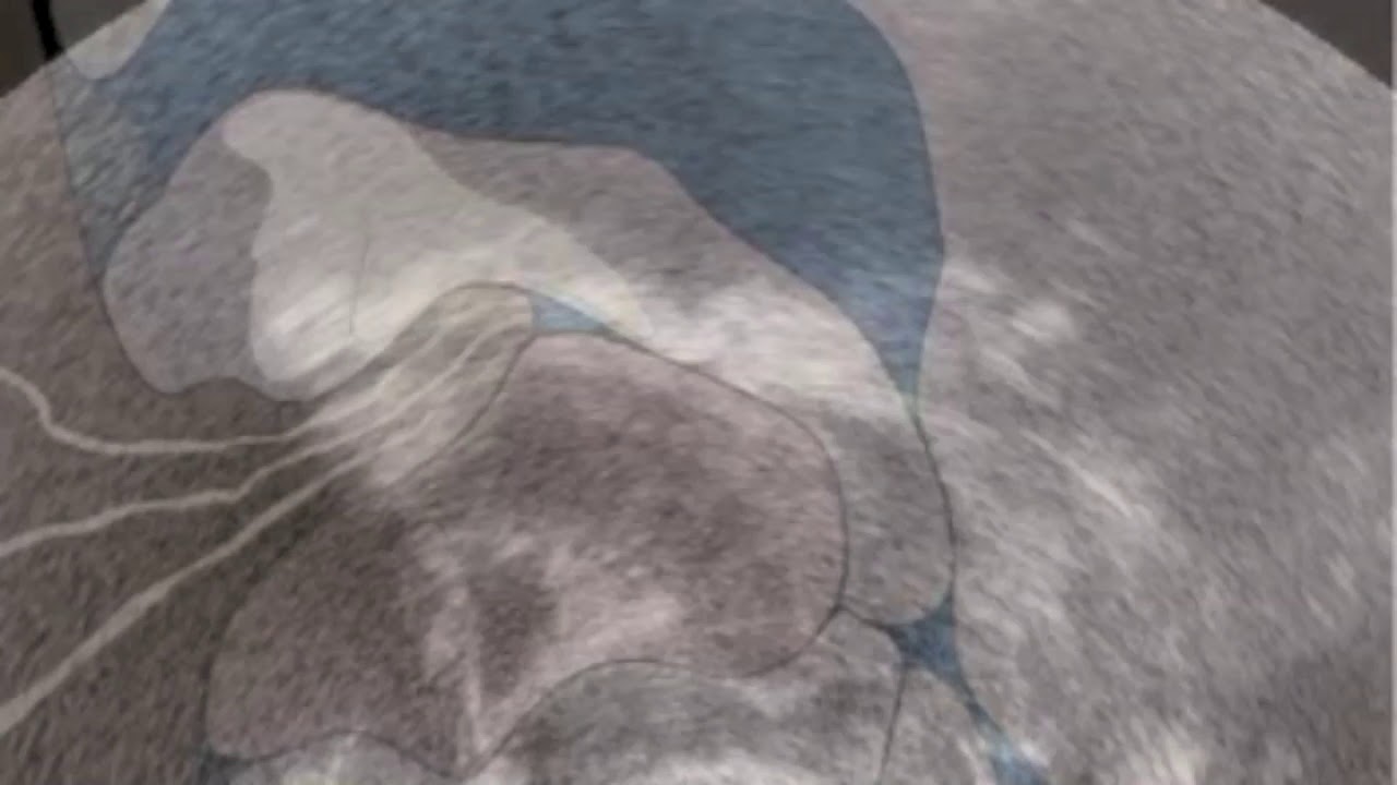 Tongue Function in Breastfeeding YouTube