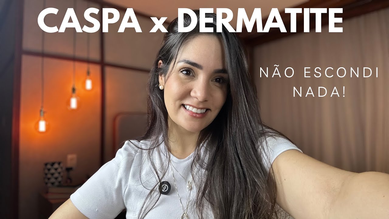 Por que sua caspa nunca melhora (e o que realmente funciona) 