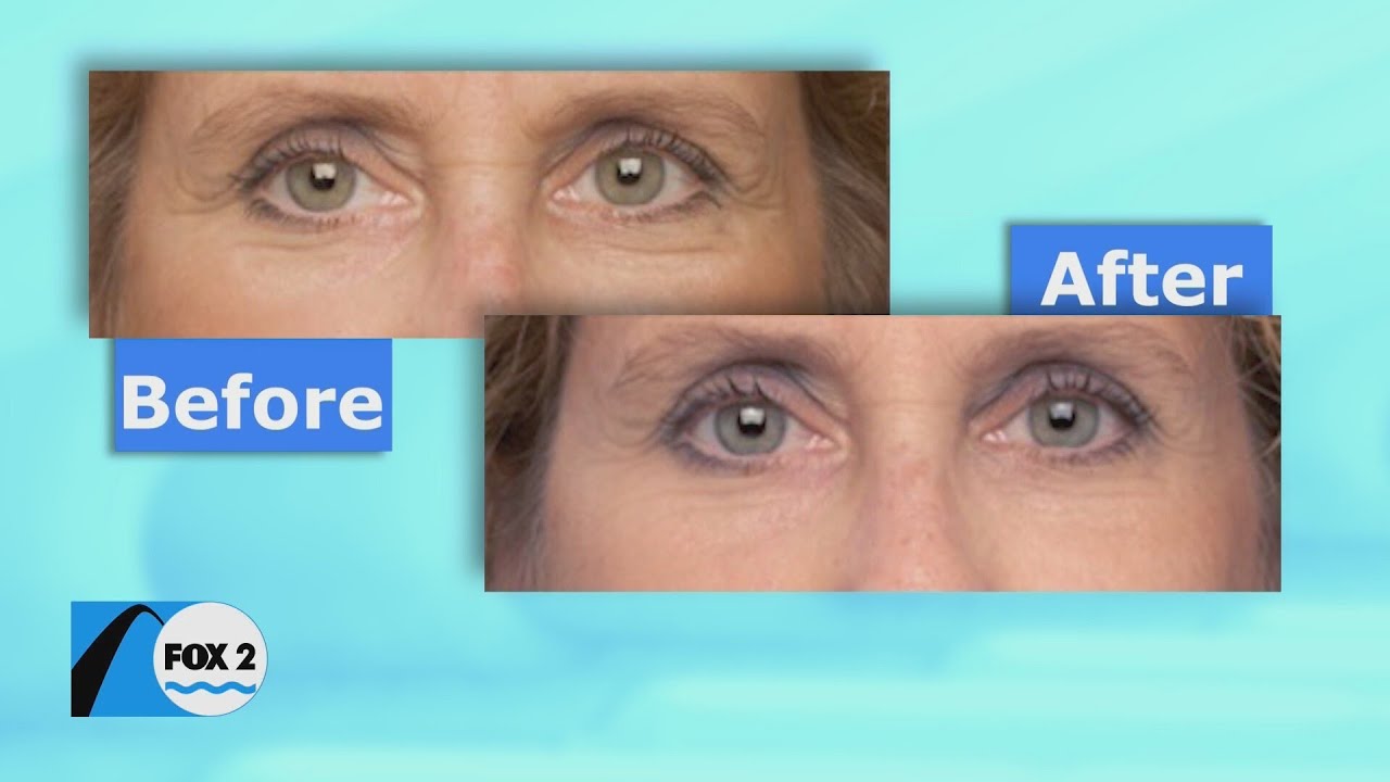 Get a perfect glow and save 25% off 2-Minute Miracle Gel