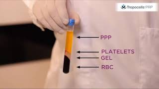Tropocells PRP 11ml