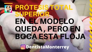 🤔❓QuÉ HACER  Cuando Queda FLOJA👅 PRÓTESIS TOTAL SUPERIOR Parte5 screenshot 1