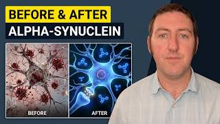Can Methylene Blue Stop Alpha-Synuclein in Parkinson's?