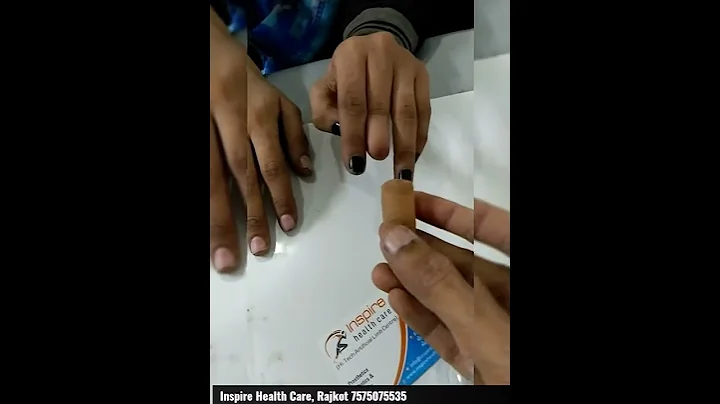 Silicone Cosmetic Finger | Inspire Health Care-Hi Tech Artificial Limb Centre | Dr. Hiren Babariya