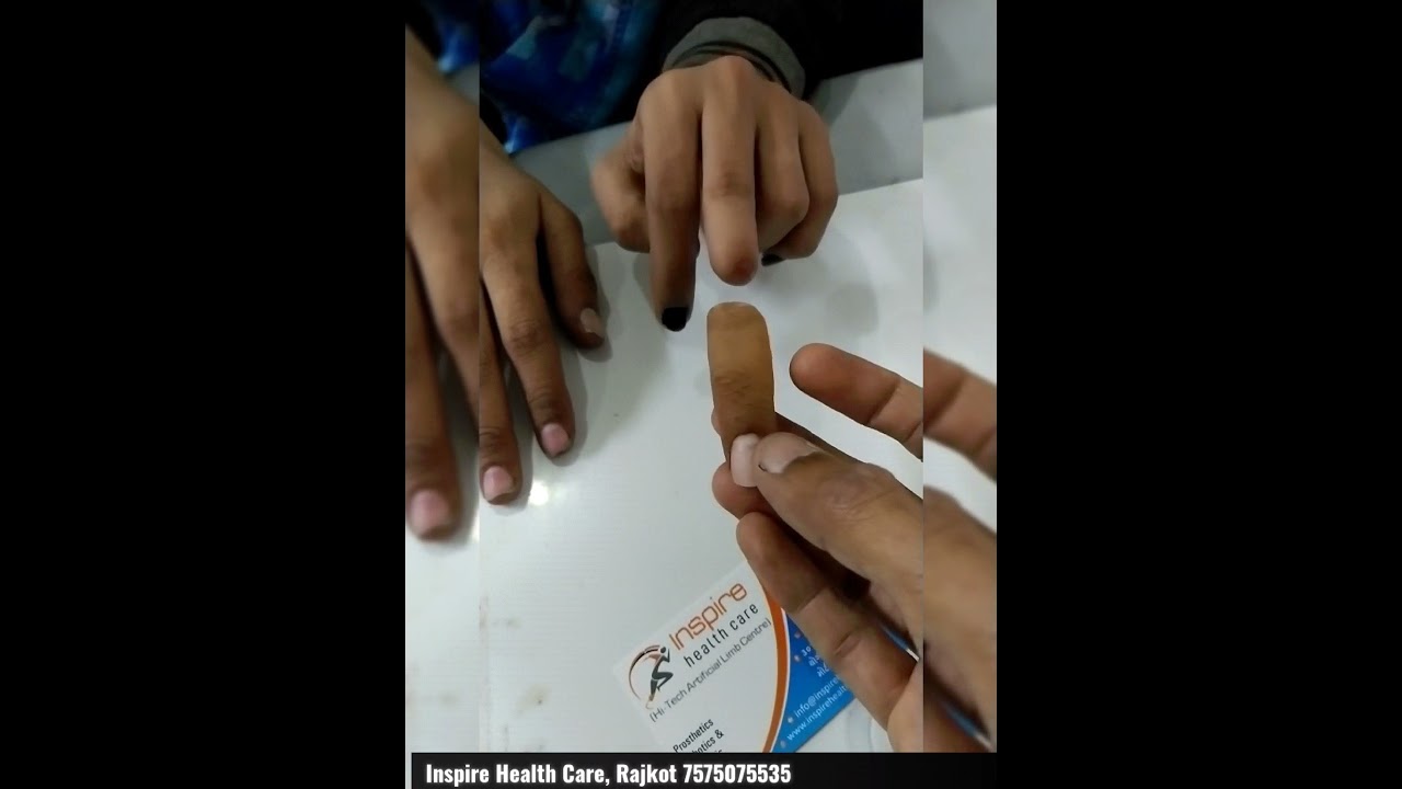 Silicone Cosmetic Finger | Inspire Health Care-Hi Tech Artificial Limb Centre | Dr. Hiren Babariya