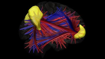 Functional connectivity of the Default Mode Network (DMN)