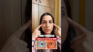 Under eye Dark circles Remedy! ✨ #FaceYoga #DarkCircles #UnderEyeCare #PuffyEyes