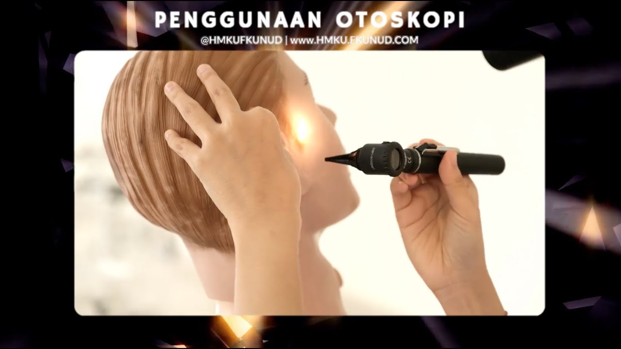 Pemeriksaan Otoskopi - Video OSCE | HMKU FK Unud