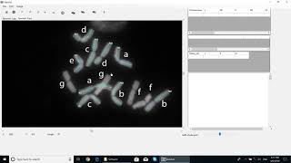 Ideokar Training Video-Free Karyotyping Tool