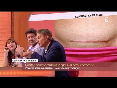 [SANTE] La chirurgie après la grossesse #CCVB