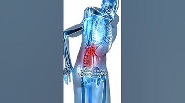 How To Locate The Quadratus Lumborum