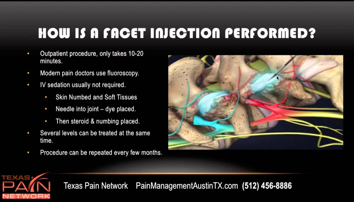 Facet Joint Injections at the Top Austin Pain Clinic (512) 456-8886