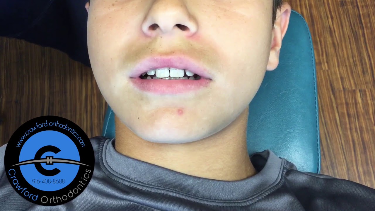 Crawford Orthodontics OHI YouTube