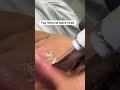 Black head and white head