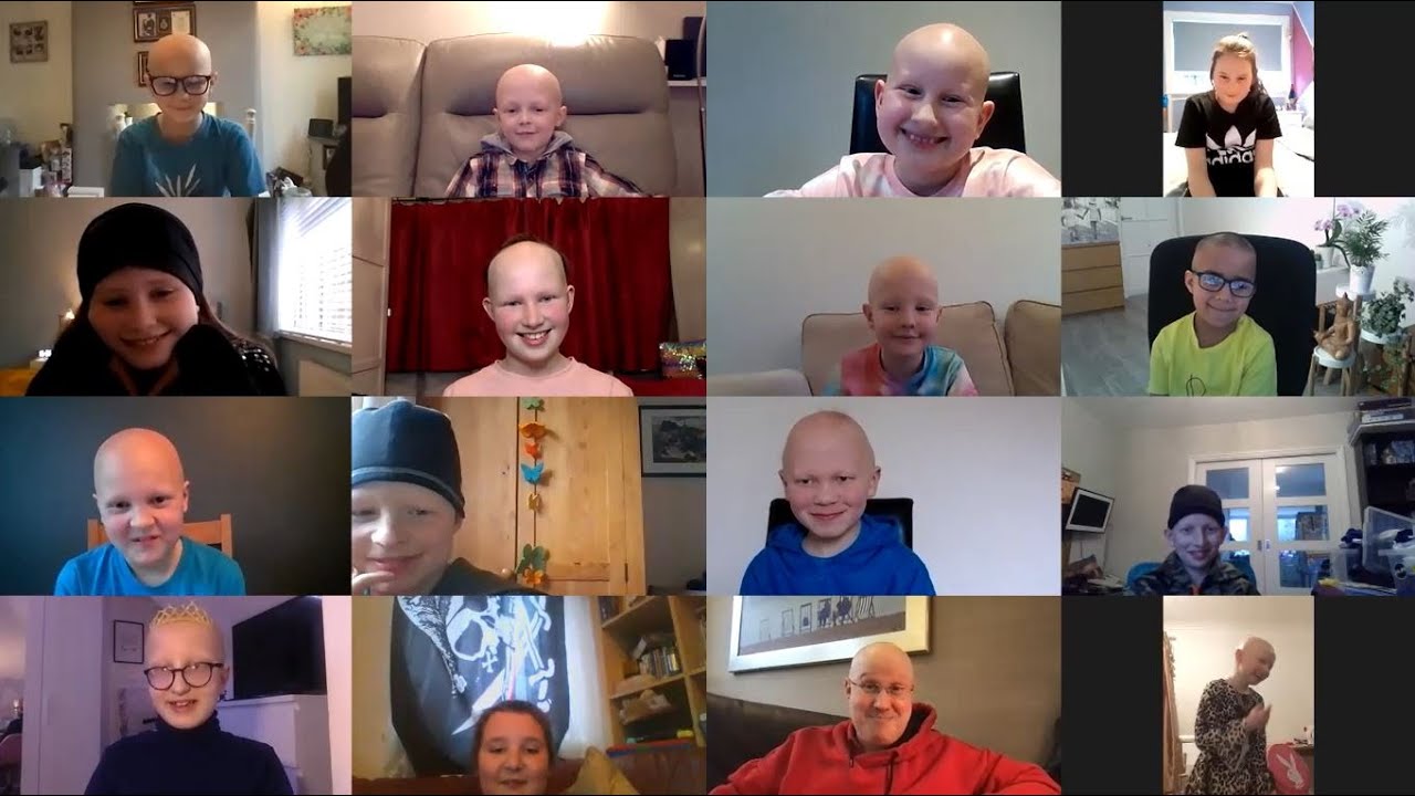 Alopecia UK interviews Matt Lucas