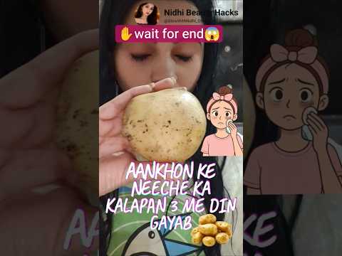 “Dark circles se pareshaan ho? 😩#darkcircles#ytshorts #beauty##eyecare #beautytiips#hack