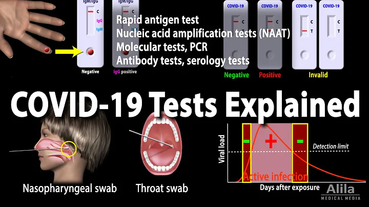 Understanding Different COVID-19 Tests, Animation - DayDayNews