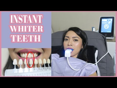 Video: Paano Maayos Na Ayusin Ang Mga Nakaplanong Pagbisita Ng Iyong Anak Sa Dentista?