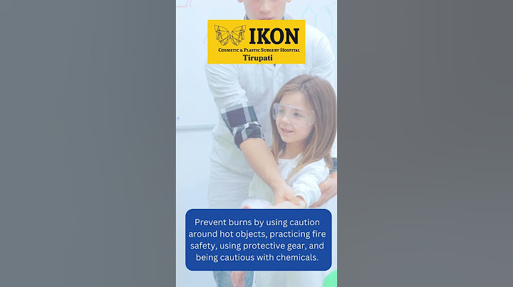 "Safety first, burns last: A guide to avoiding burn injuries." #ikon #handsurgeon #hospital #nerve