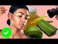 5 Beneficios Aloe Vera Para Tu Cuerpo 🌵 Piel Sin Acne y Arrugas. Prepara Aceite de Sábila.