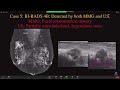 Surgical board review 2021 - lecture Imaging MCQ Breast