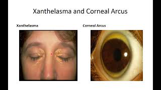 CVS Physical Video theory