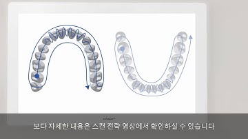 3DBioCAD - 3Shape 트리오스 스캔 전략 교합 스캔 Bite