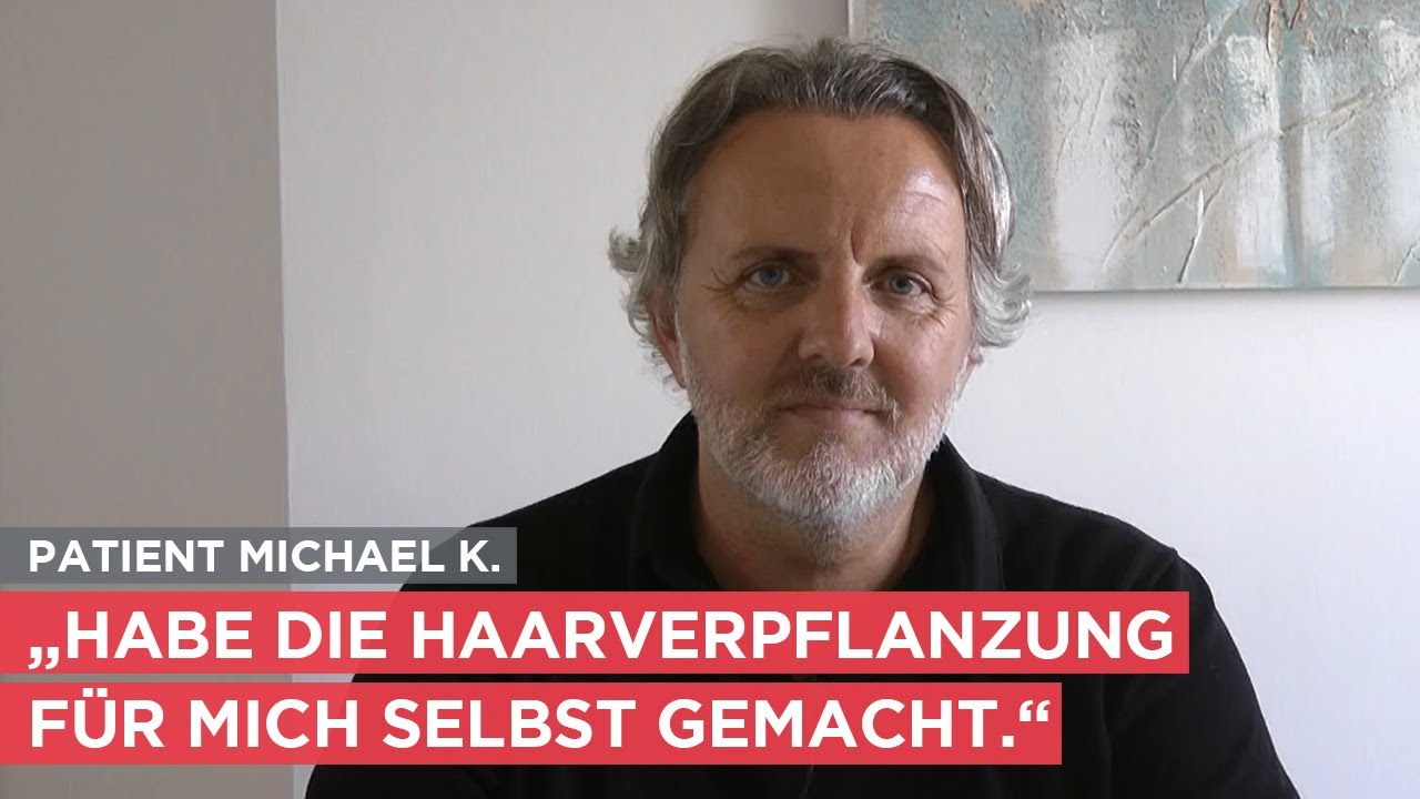 Patient stellt Ergebnis seiner Haarverpflanzung vor | Michael wurde behandelt in der Moser Klinik