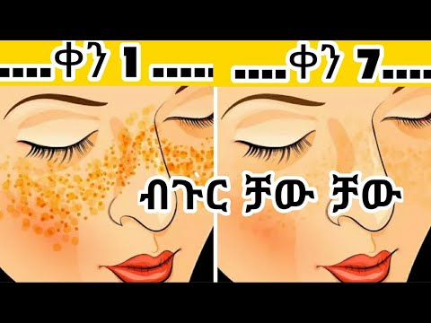 ቪዲዮ: ብጉር (ጥቁር ነጠብጣቦች) በድመት እና ድመት ላይ አገጭ ላይ: - ከፀጉሩ በታች እንደ ቆሻሻ ያሉ እህሎች እንዲታዩ የሚያደርጉ ምክንያቶች