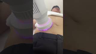 Abdomen Shaping  | Anti-aging Wrinkle Removal Body Massage Therapy Machine
