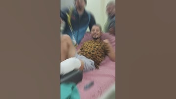 tibia bone break & recovery || #tibia #recovery