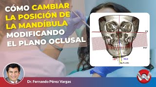 Cómo Cambiar la Posición de la Mandíbula Modificando el Plano Oclusal