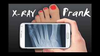 Xray Scanner Prank screenshot 5