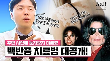 자살까지 불러온다는 백반증 도대체 어떤병일까요? / 불치병은 아니다 / 연세에이앤비 피부과 이해진원장