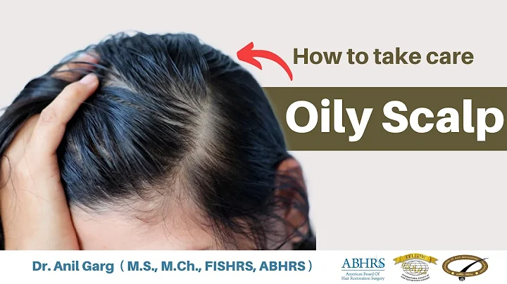 How To Treat Oily Scalp | Know Home Remedies, Treatment | Greasy Scalp - DayDayNews