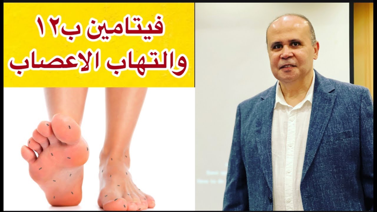 علامات نقص فيتامين ب١٢ 👈تجنب التعب والارهاق 👈👈افضل مصادر تحتوي علي فيتامين ب١٢