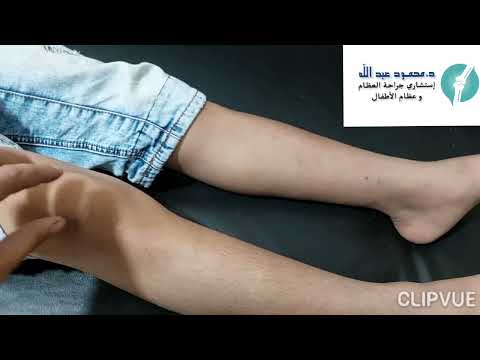 ألم الركبة عند الأطفال مع دكتور محمود عبدالله