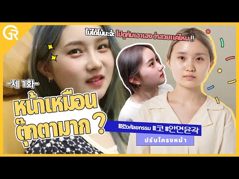 Vlog !! รีวิวศัลยกรรมเกาหลีที่กิริน #เปิดหางตา #จมูก #ปรับโครงหน้า หลังทำจะสวยแค่ไหน ไปดูกันเล้ยย