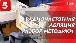 Выпуск 5. Просто о сложном: Радиочастотная абляция: как это работает? Почему пациент в сознании?