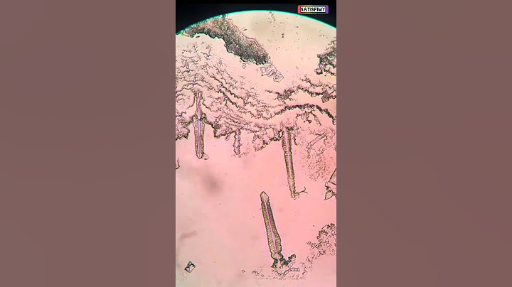 Happy Tears Examination Under Microscope 😱 #shorts #viral #fun #tears